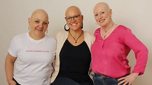 Las 'pelonas', mujeres que visibilizan la alopecia en Barcelona: "Llevaba peluca y ahora no me avergüenzo"