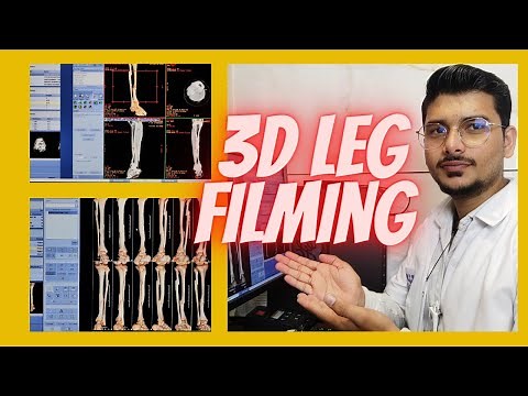 3D Leg CT Scan filming process & techniques | 3D CT Scan Leg filming.