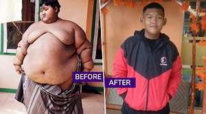 Indonesia's Fattest Teenager Arya Permana Loses 110kg, Amazing Body Transformation With Before And After Pictures Go Viral | 👍 LatestLY