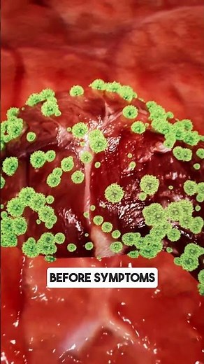 Hepatitis B Surface Antigen (HBsAg) Test