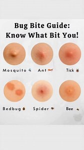 🪲 Identify the Bites: How to Recognize Common Insect Bites 🪲 Ever wondered why some bites itch like crazy while others barely leave a mark? Learning to identify common insect bites can help you treat them properly and avoid future encounters. Materials/Tools Needed: Notebook or smartphone (to document bites) Magnifying glass (optional, for closer inspection) Camera (to take photos for reference) Antihistamine cream or soothing lotion (for relief after identification) Step-by-Step Method: Obser