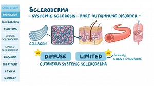 Video: Scleroderma: Pathology review - Video Explanation! | Osmosis | Osmosis