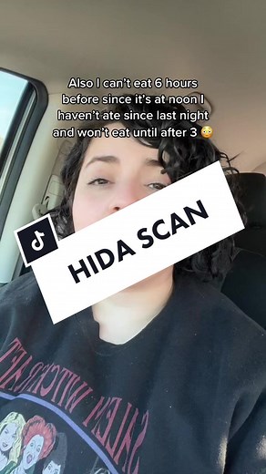 HIDA scan day! #hidascan #hepatobiliary #healthupdate #scanday #gallbladder #healthjourney