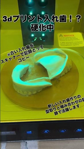 3dプリント入れ歯硬化中