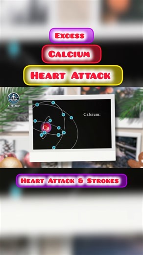 Excess Calcium: A Hidden Cause of Heart Attacks