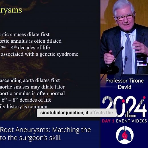 Surgical Treatments of Aortic Root Aneurysms: 2024 London Core Review Cardiothoracic Surgery Course
