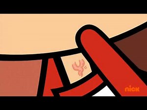 Lynn's anger vein for 10 minutes