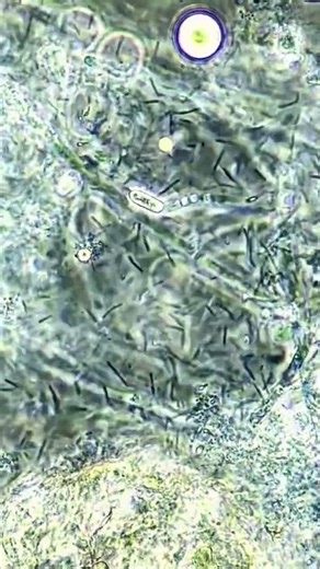 Bacteria vs hydrogen peroxide under the microscope