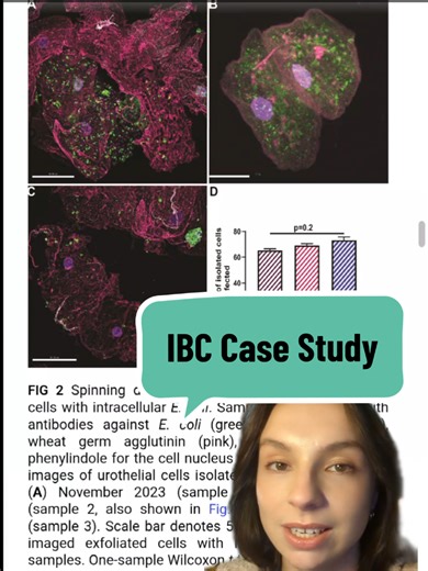 Today's paper presents the case study of a paediatric patient with chronic UTIs, whose story has led to the creation of a vital database. #ChronicUTI #lLiveUTIFree #MedicalMisogyny #IBCs #HealthResearch Paper: https://journals.asm.org/doi/10.1128/asmcr.00077-25 Article: https://www.sydney.edu.au/news-opinion/news/2026/01/07/new-database-to-target-chronic-utis---a-long-overlooked-conditio.html?campaign=news-opinion&source=email&area=university&a=public&type=o&pid=weekly