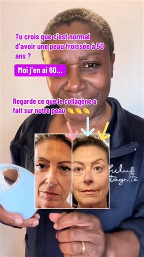 Découvrez les bienfaits du collagène pour votre peau