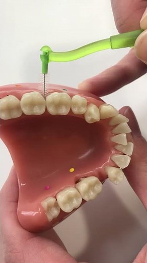 Using an Interdental Brush