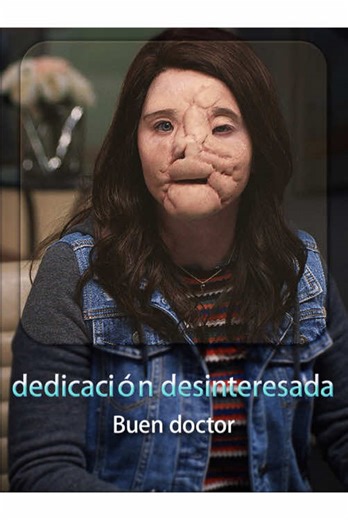 #fyp #fyppppppppppppppppppppppp #movie | hair transplant