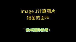 利用Image j/Fiji 计算图片中细菌细胞的面积
