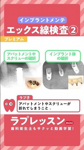 【ラプレッスンmini】インプラントメインテナンス メインテナンス 診査編 ③〜エックス線検査〜