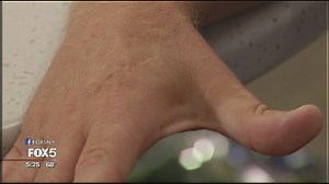 Vending machine company to microchip employees