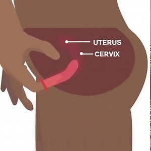 1.1K views · 3 comments | There are a lot of people who are scared to try an internal (aka female) condom because they are not sure how these condoms are used. Check out this short video to see how internal condoms are inserted. loveLife Soul City Institute | BWise | Facebook