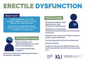 Erectile Dysfunction: Symptoms, Causes & Treatment – Katelaris Urology