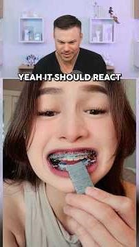 Are Your Braces MAGNETIC?! 🧲🦷