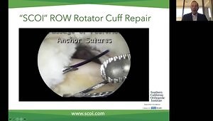 Single Row Repair: Low Cost, High Healing - "SCOI Row" Repair