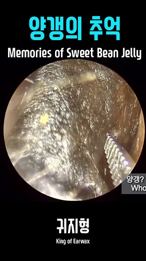 Effective Earwax Removal Techniques