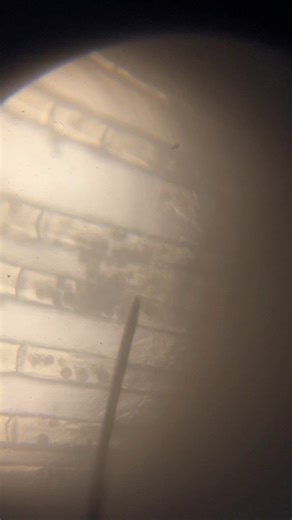 Chilodonella เป็น “ฆาตกรเงียบ” ที่ทำลายเหงือกปลาจนหายใจไม่ออก มักมองไม่เห็นด้วยตาเปล่า หากมีปริมาณมากจะทำให้ปลาระคายเคืองเครียดและเกิดความเสียหายได้ | Cube Aquarium