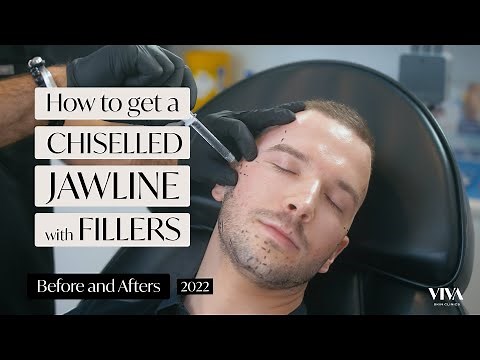 Chiseled Jawline with Fillers| Total Transformation | Before and Afters Jawline filler 2022