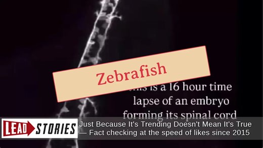 Fact Check: Timelapse Shows Zebrafish Nervous System Developing In Sixteen Hours -- Not Human Embryo Spinal Cord
