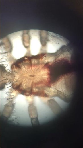 Louse under microscope #louse #insect #microscope