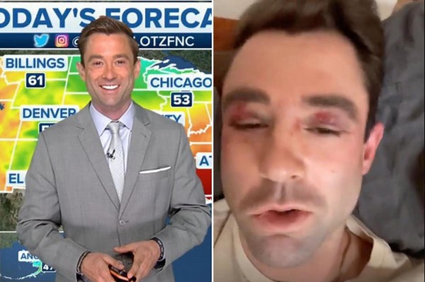 Fox weatherman Adam Klotz beaten on NYC subway train