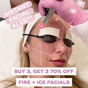 Ready for a glow-up? Fire Ice facials brighten skin and build collagen, and during our 70th Location Sale-A-Bration you can enjoy Buy 3 Get 3 70% off! | LaserAway