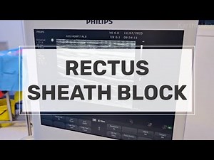 Rectus Sheath Block for midline incisions