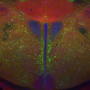 The Neural Circuit Underlying Leptin has Been Revealed | Cell And Molecular Biology