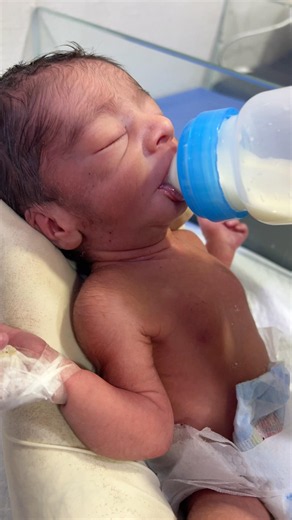 First Feeding of a Newborn in NICU 💙 | Essential Care Guide #baby #feedshorts
