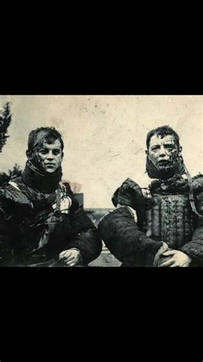 Infamous Boundaries on Instagram: "German fencing students getting their dueling scars, circa 1900. Dueling scars have been seen as a “badge of honour” since as early as 1825. Known variously as “Mensur scars”, “the bragging scar”, “smite”, “Schmitte”, or “Renommierschmiss”, dueling scars were popular amongst upper class Germans and Austrians involved in academic fencing at the start of the 20th century. Being a practice amongst university students, it was seen as a mark of their class and honou