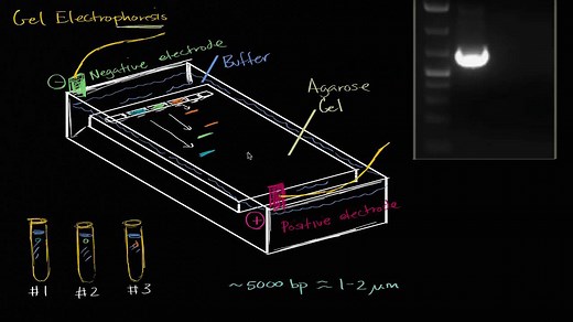 Gel electrophoresis