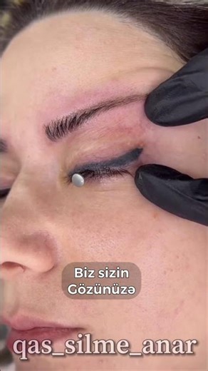 Liner Silinmesi #tattoosilme #qassilme #tattoo #microbladingsilme #qaş