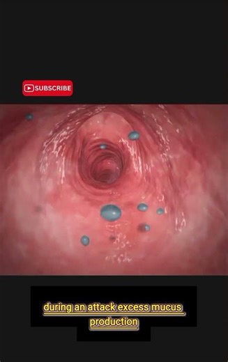 ASTHMA (Part II): Living With the Disease | Causes, Triggers, and Daily Struggles