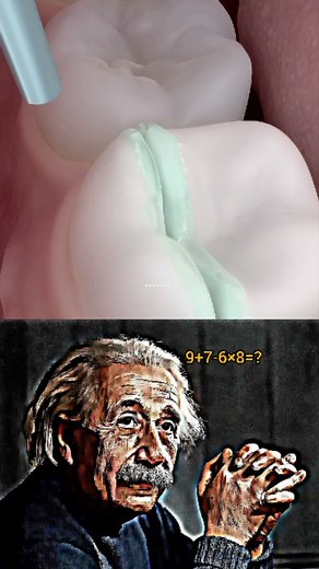 1K reactions · 8 comments | How Dentists Repair A Split Tooth  | BrainAuraa | Facebook