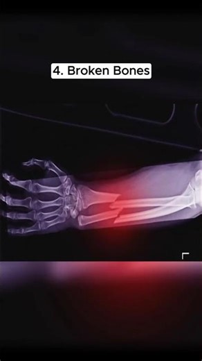 This Is the Most Painful Thing a Human Can Experience 💀