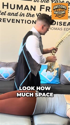 Locating the pisiform bone for chiropractic adjustments can be tricky. The key is stabilization and precise positioning—getting close enough to feel the spinous process. Proper technique makes all the difference. #Chiropractic #Adjustment #Pisiform #SpineHealth #Technique | Awesome Family Chiropractic