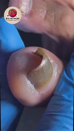 1019. Teas and herb drinks that fit intermittent fasting #BalancedNutrition #HealthyHabits #EducationWellness | Bye