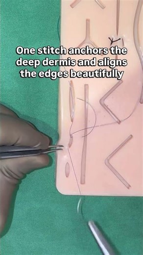 Still Waiting for Closure After a Breakup? Surgeons Do It This Way | Half-Buried Mattress Suture
