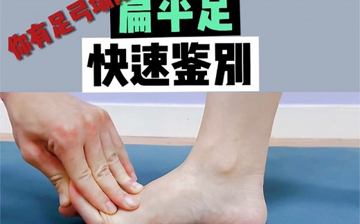 你有扁平足吗？一个方法快速鉴别
