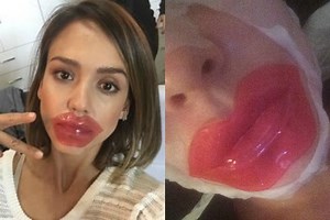 Maschera per le labbra: ecco l’ultima mania beauty delle star (FOTO)