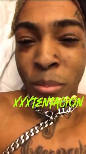 XXXTENTACION ⚡ The pain, energy, and passion in his music still hits different 🖤🔥