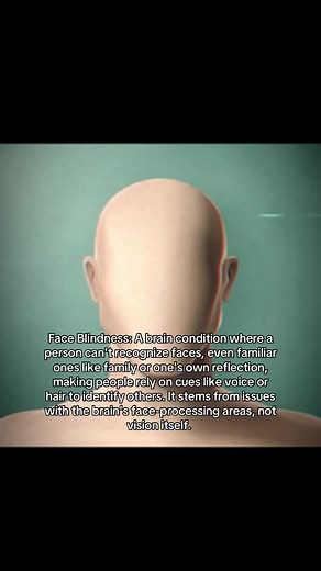 Understanding Face Blindness: Causes and Impacts