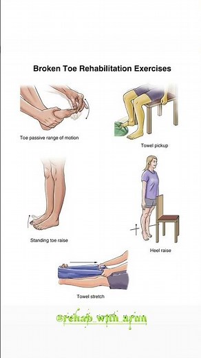 Broken Toe Rehabilitation Exercise -: #physicaltherapy #physiotherapy