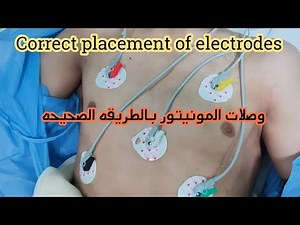 كيفية وضع وصلات المونيتور بالشكل الصحيح - Correct placement of electrodes