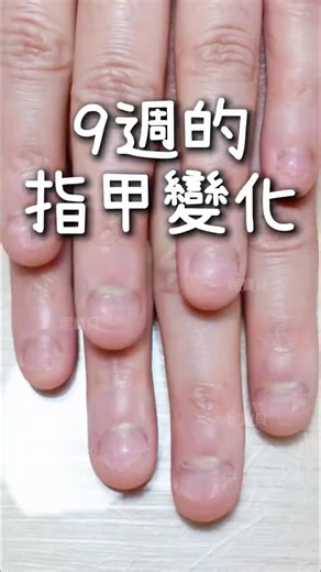 Nail changes in nine weeks