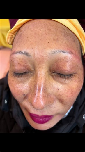 Microblading Techniques and Benefits